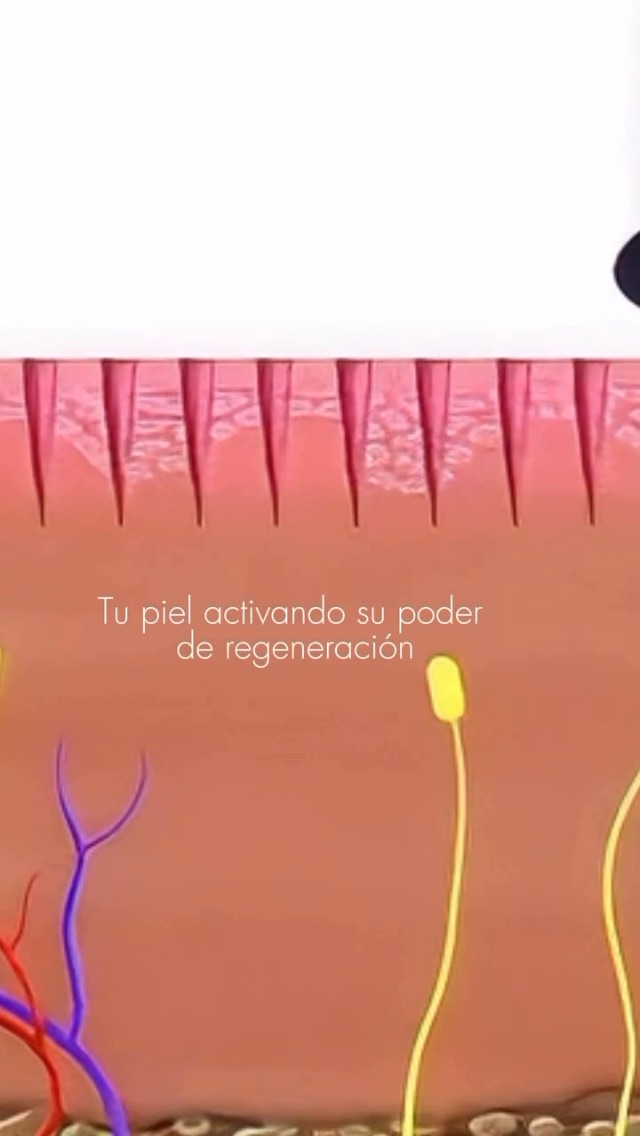 Tratamiento 12