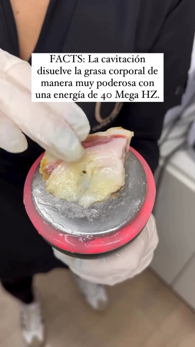Tratamiento 8